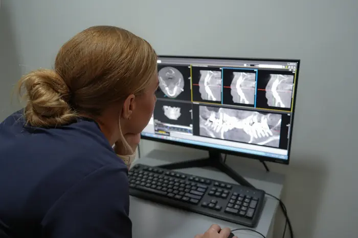 Una doctora revisa en pantalla las imágenes de un TAC dental en 3D