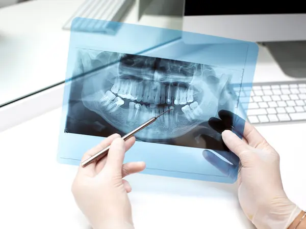 Dentista señalando una radiografía dental